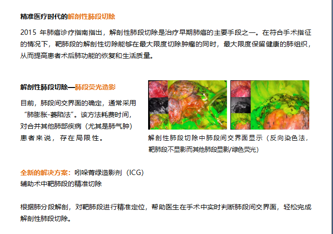 文中插图剪切.png